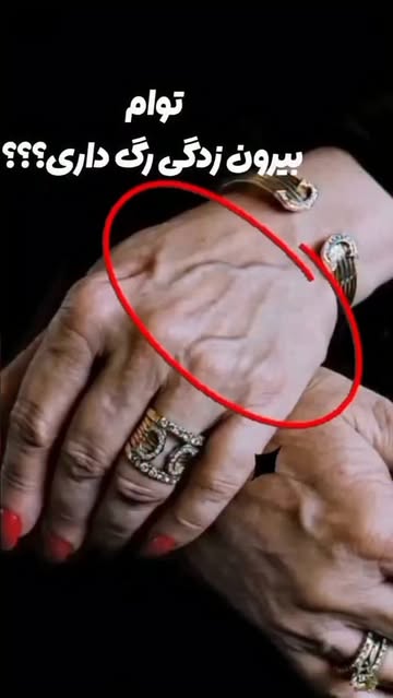 پست اینستاگرام DcrY37GIRNQ