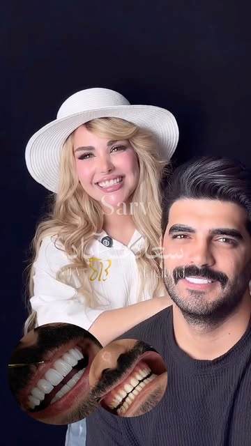 پست اینستاگرام DdHJQhZKlPO