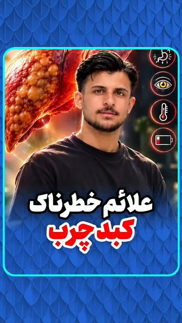 پست اینستاگرام DdHlQ0sCSGz