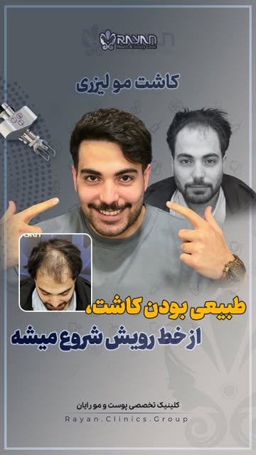 پست اینستاگرام DdI9WcJuQFM