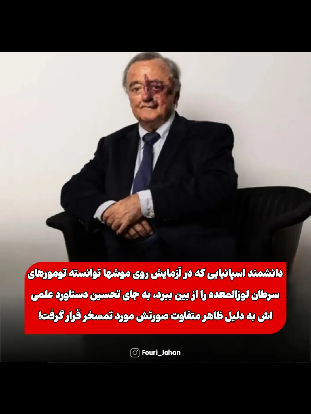 پست اینستاگرام DdL5eKks-pa