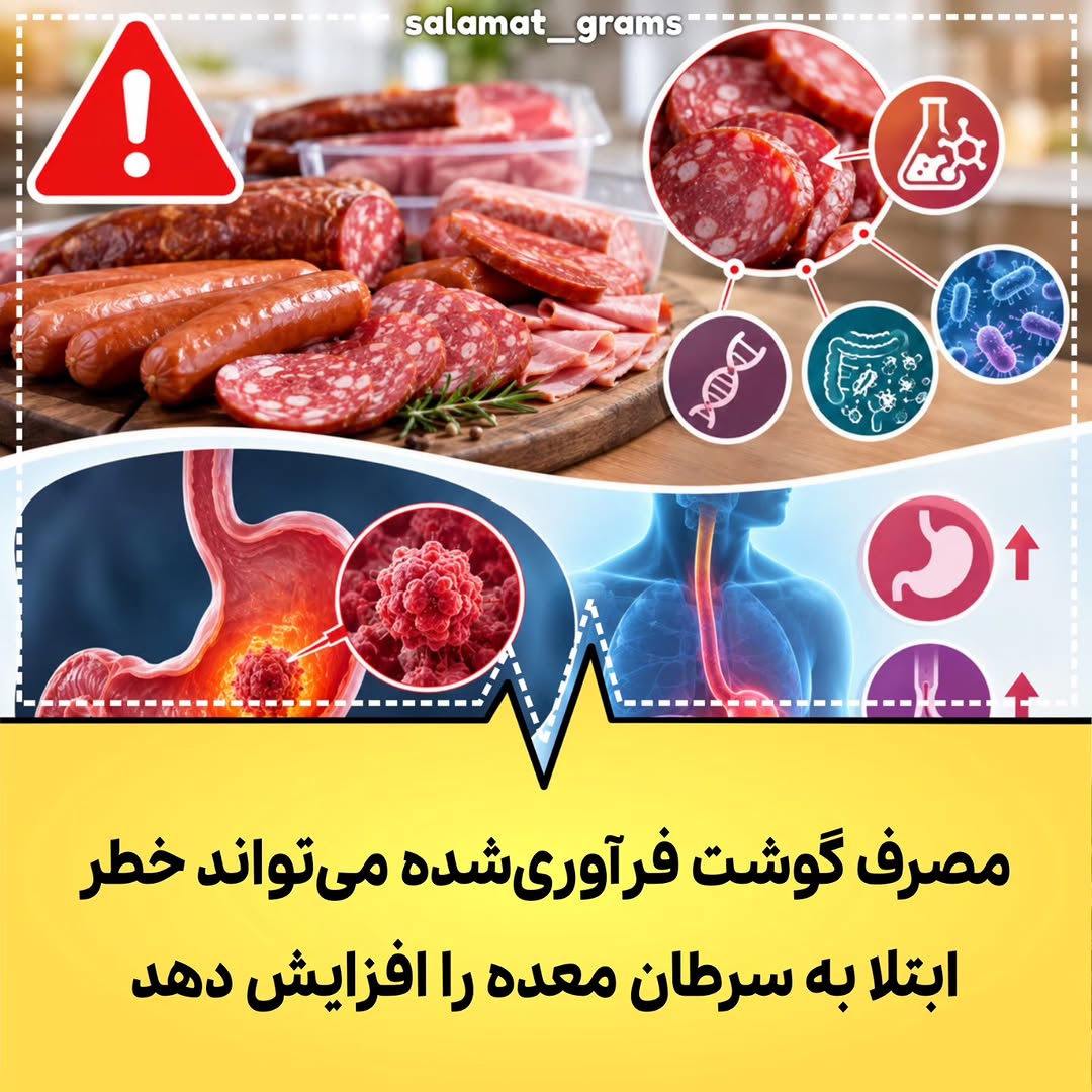 پست اینستاگرام DdM1jMuOp95