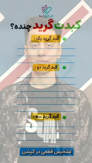پست اینستاگرام DdMoSLgq6yi