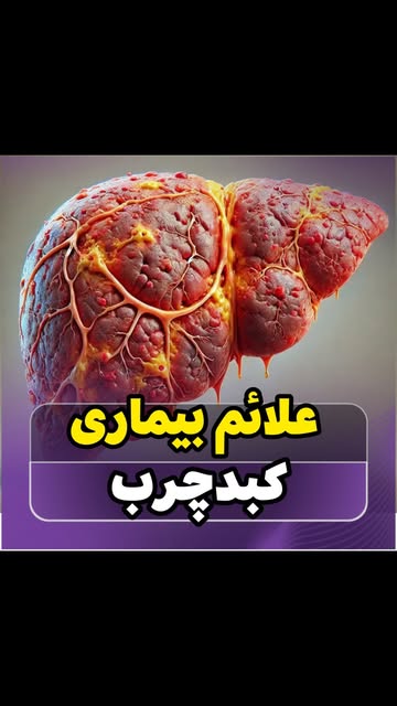 پست اینستاگرام DdMvoarxyja