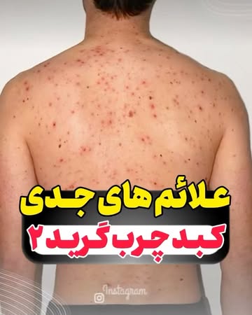 پست اینستاگرام DdPFa8Tjb8D