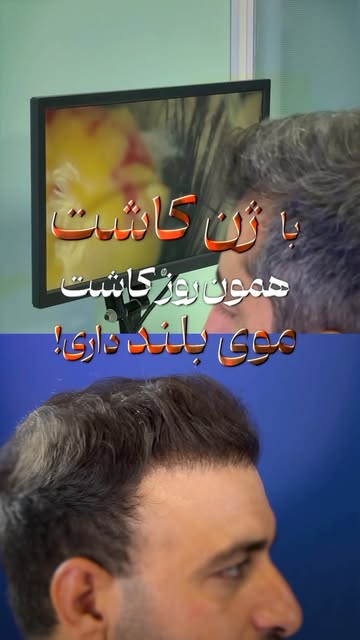 پست اینستاگرام DdQ33aaMh88