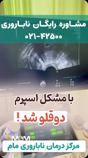 پست اینستاگرام DdTMDcwP63-